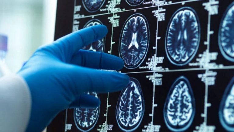 Discovery offers hope to children with rare and severe epilepsy